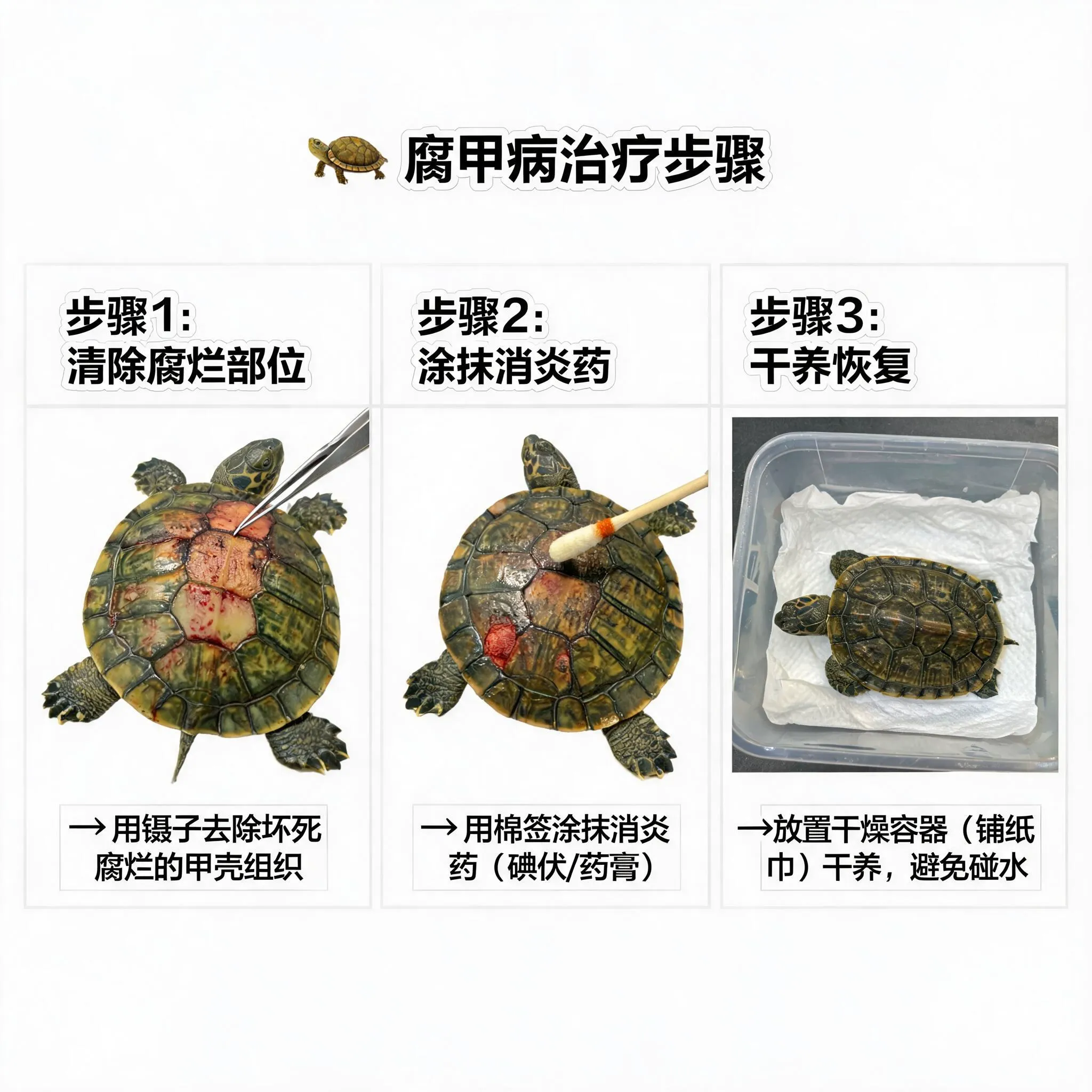 腐甲病治疗步骤